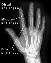 Two Phalanges of Index Finger