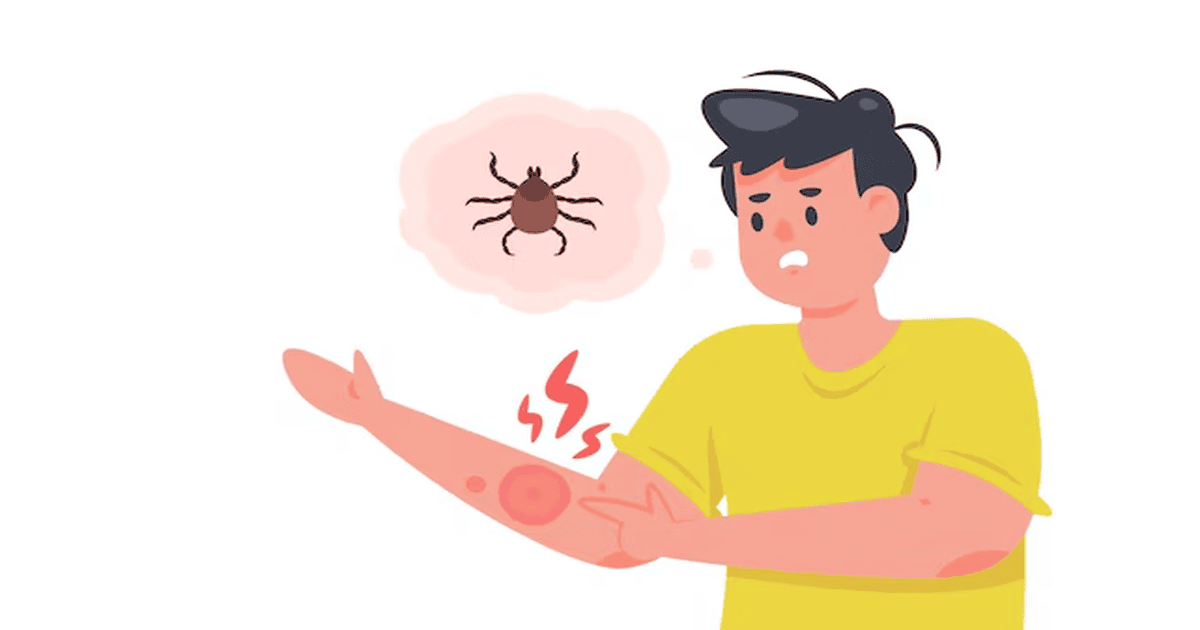 Do Termites Bite People?